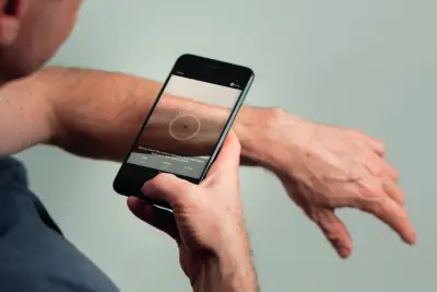 Download SkinVision | Skin Cancer Melanoma Detection App