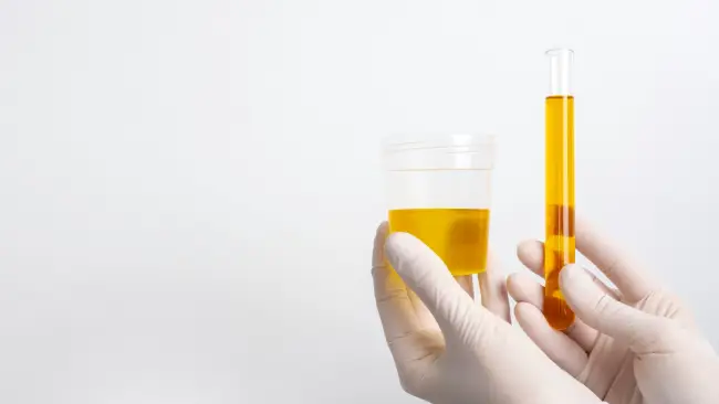 Infecção de Urina