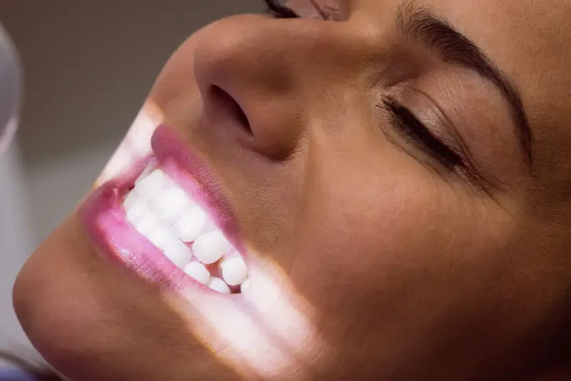 Clareamento com laser