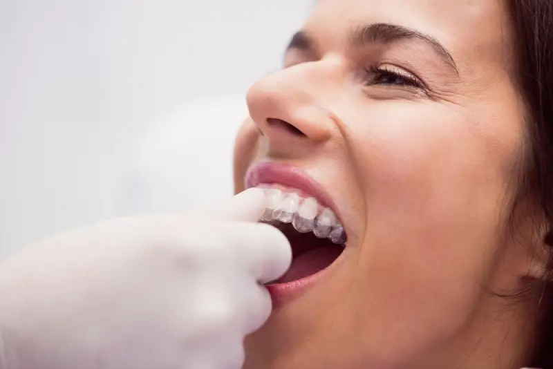 Clareamento dental