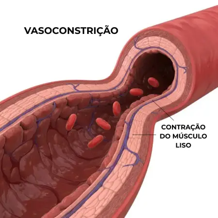 Infarto e AVC no frio