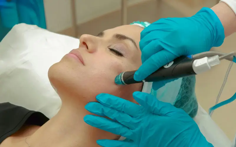 Lifting Facial não cirúrgico
