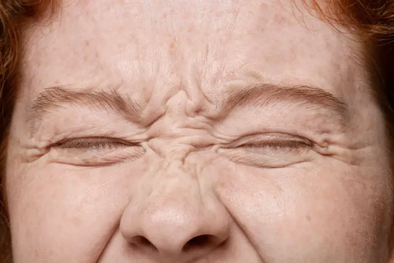 Diferença entre rugas e linhas de expressão